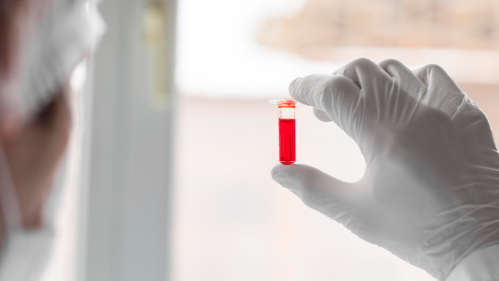 Hemoglobin: Si Kunci Penting dalam Darah yang Perlu Kamu Tahu!